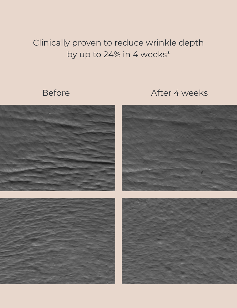 INIKA Organic Bakuchiol Serum Natural Retinol Alternative